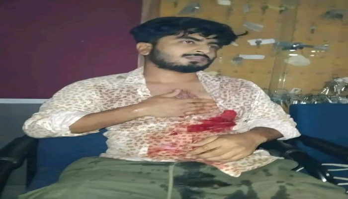 ​মনে পড়ে আমার ভাই পারভেজ হত্যার কথা?